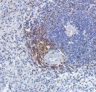 Immunohistochemistry (Formalin/PFA-fixed paraffin-embedded sections) - Anti-TCR beta antibody [SP305] - BSA and Azide free (AB325979)