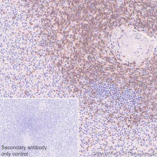 Immunohistochemistry (Formalin/PFA-fixed paraffin-embedded sections) - Anti-TCR beta antibody [SP305] - BSA and Azide free (AB325979)