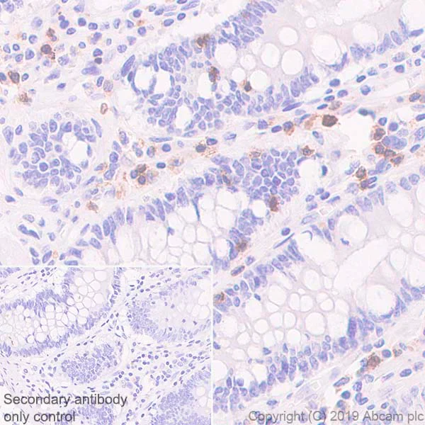 Immunohistochemistry (Formalin/PFA-fixed paraffin-embedded sections) - Anti-TCR beta antibody [SP305] - BSA and Azide free (AB325979)