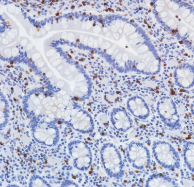 Immunohistochemistry (Formalin/PFA-fixed paraffin-embedded sections) - Anti-TCR beta antibody [SP305] - BSA and Azide free (AB325979)