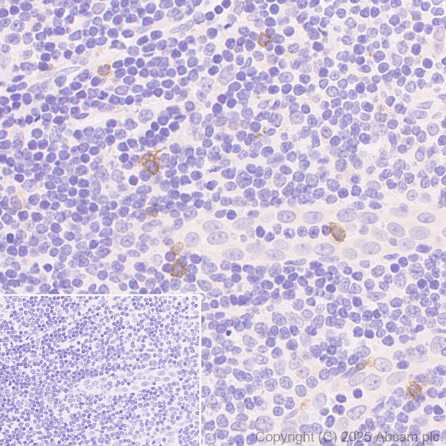 Immunohistochemistry (Formalin/PFA-fixed paraffin-embedded sections) - Anti-TCR delta antibody [EPR27043-16] (AB313573)