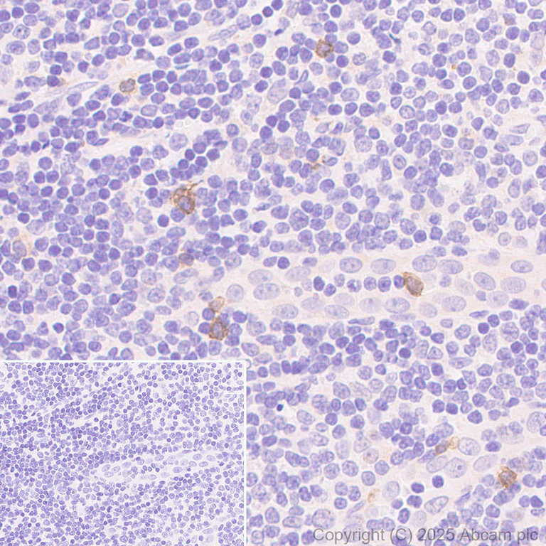 Immunohistochemistry (Formalin/PFA-fixed paraffin-embedded sections) - Anti-TCR delta antibody [EPR27043-16] - BSA and Azide free (AB313574)