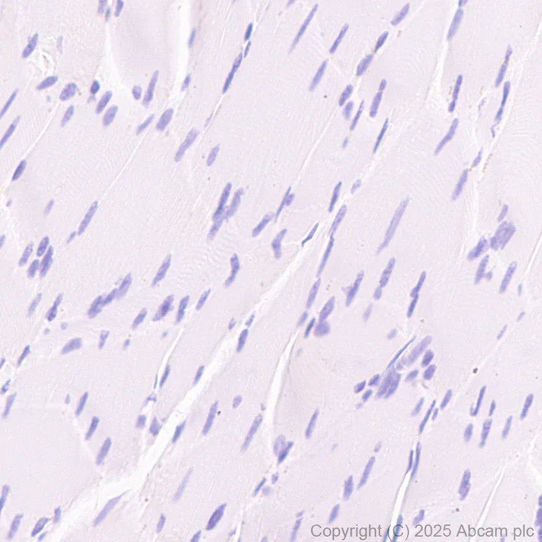 Immunohistochemistry (Formalin/PFA-fixed paraffin-embedded sections) - Anti-TCR delta antibody [EPR27043-16] - BSA and Azide free (AB313574)