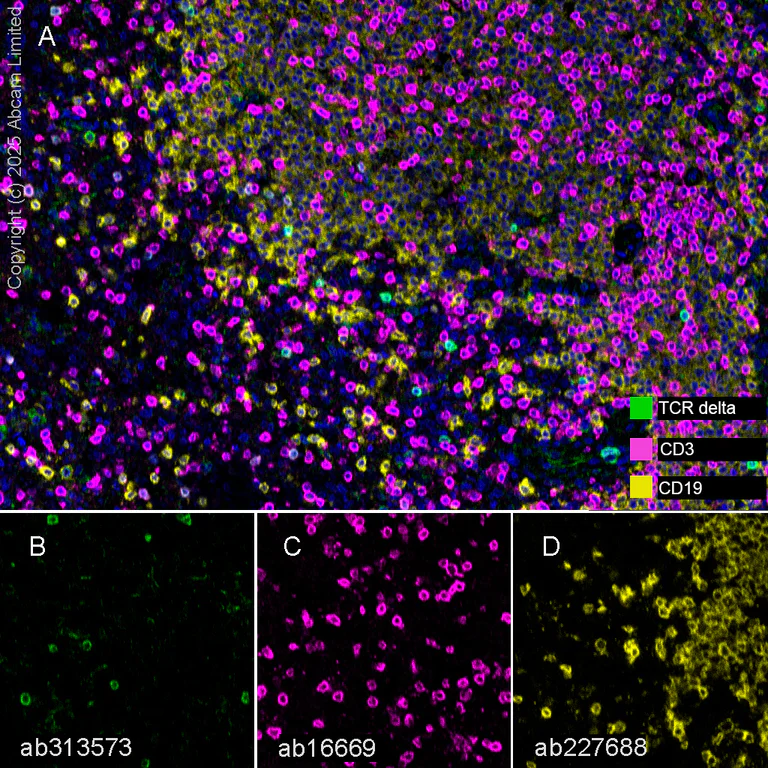 Multiplex immunohistochemistry - Anti-TCR delta antibody [EPR27043-16] - BSA and Azide free (AB313574)
