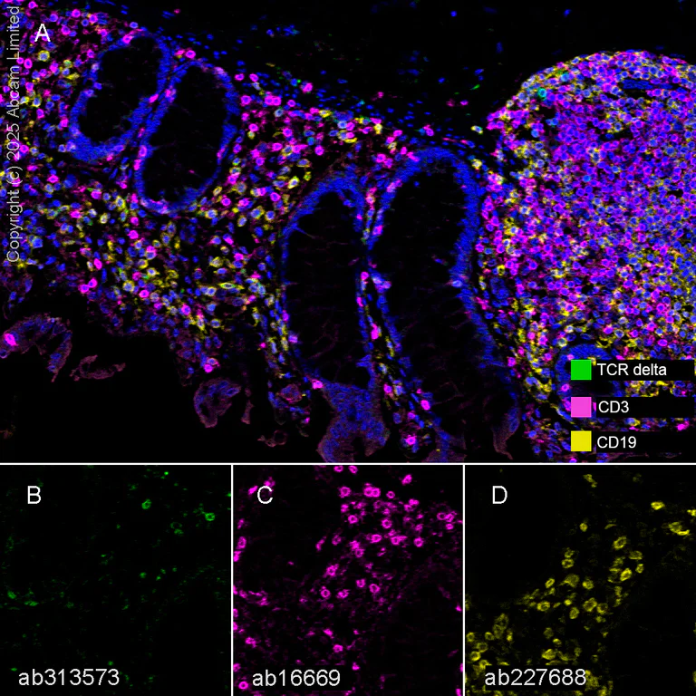 Multiplex immunohistochemistry - Anti-TCR delta antibody [EPR27043-16] - BSA and Azide free (AB313574)