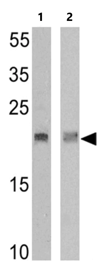 Western blot - Anti-TCR V delta 2 antibody [15D] (AB171103)