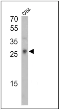 Western blot - Anti-TCR V gamma 9 antibody [7A5] (AB171109)