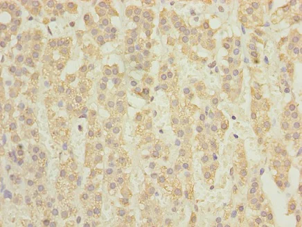 Immunohistochemistry (Formalin/PFA-fixed paraffin-embedded sections) - Anti-TCTA antibody (AB235781)