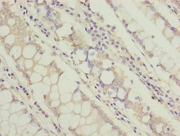 Immunohistochemistry (Formalin/PFA-fixed paraffin-embedded sections) - Anti-TCTA antibody (AB235781)