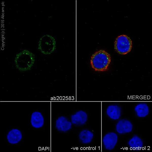 Immunocytochemistry/ Immunofluorescence - Anti-TCTEX-1 antibody [EPR17294] (AB202583)
