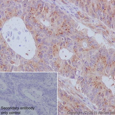 Immunohistochemistry (Formalin/PFA-fixed paraffin-embedded sections) - Anti-TCTEX-1 antibody [EPR17294] (AB202583)