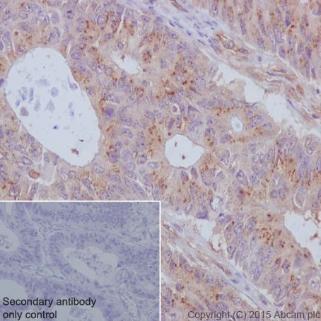 Immunohistochemistry (Formalin/PFA-fixed paraffin-embedded sections) - Anti-TCTEX-1 antibody [EPR17294] (AB202583)