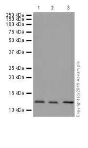 Western blot - Anti-TCTEX-1 antibody [EPR17294] (AB202583)