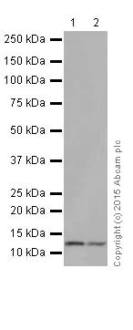 Western blot - Anti-TCTEX-1 antibody [EPR17294] (AB202583)