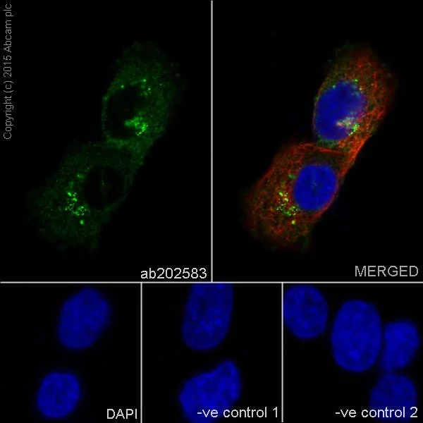 Immunocytochemistry/ Immunofluorescence - Anti-TCTEX-1 antibody [EPR17294] - BSA and Azide free (AB251377)