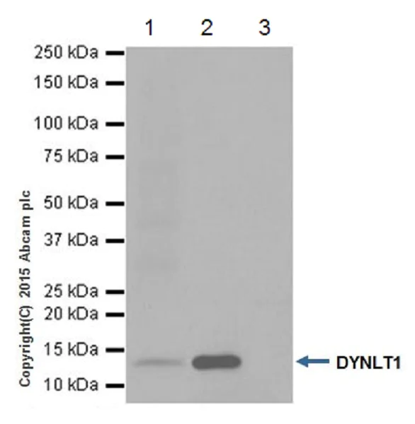 Immunoprecipitation - Anti-TCTEX-1 antibody [EPR17294] - BSA and Azide free (AB251377)