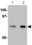 Western blot - Anti-TCTN1 antibody (AB105381)