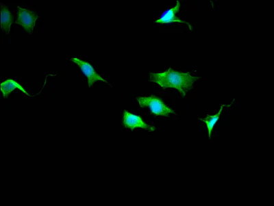 Immunocytochemistry/ Immunofluorescence - Anti-TCTP antibody [10A9] (AB314167)