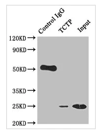 Immunoprecipitation - Anti-TCTP antibody [10A9] (AB314167)