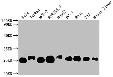 Western blot - Anti-TCTP antibody [10A9] (AB314167)