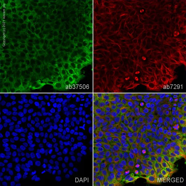 Immunocytochemistry/ Immunofluorescence - Anti-TCTP antibody (AB37506)