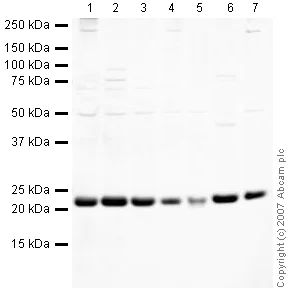 Western blot - Anti-TCTP antibody (AB37506)