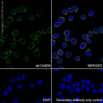 Immunocytochemistry/ Immunofluorescence - Anti-TCTP antibody [EP5541] (AB124835)