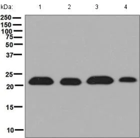 Western blot - Anti-TCTP antibody [EPR5540] (AB133568)