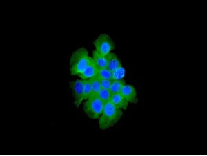 Immunocytochemistry/ Immunofluorescence - Anti-TCTP antibody [EPR5540] - BSA and Azide free (AB232504)