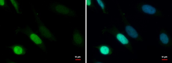 Immunocytochemistry/ Immunofluorescence - Anti-TDG antibody (AB227498)