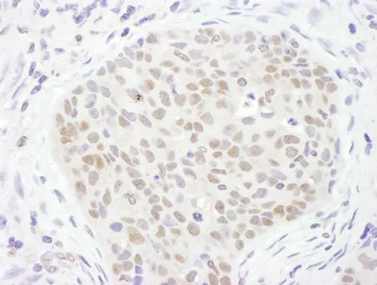 Immunohistochemistry (Formalin/PFA-fixed paraffin-embedded sections) - Anti-TDG antibody (AB245620)