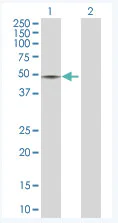 Western blot - Anti-TDO2/TDO antibody (AB76859)