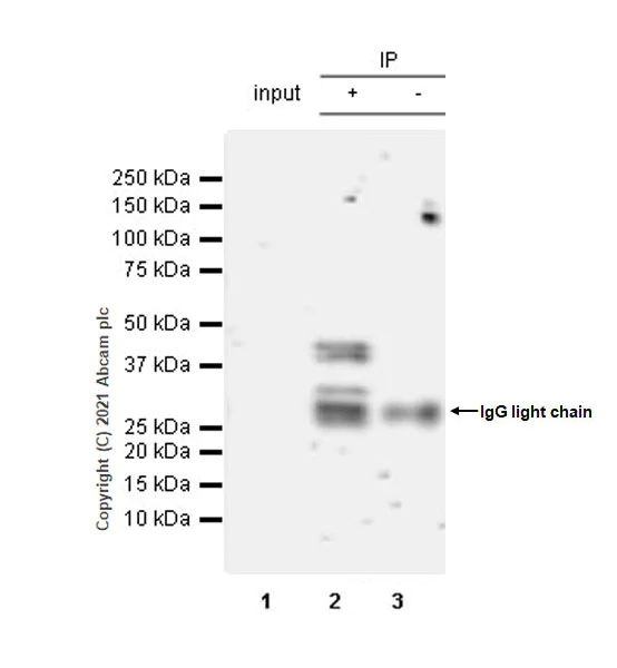 Immunoprecipitation - Anti-TDO2/TDO antibody [EPR23745-311] - BSA and Azide free (AB281571)