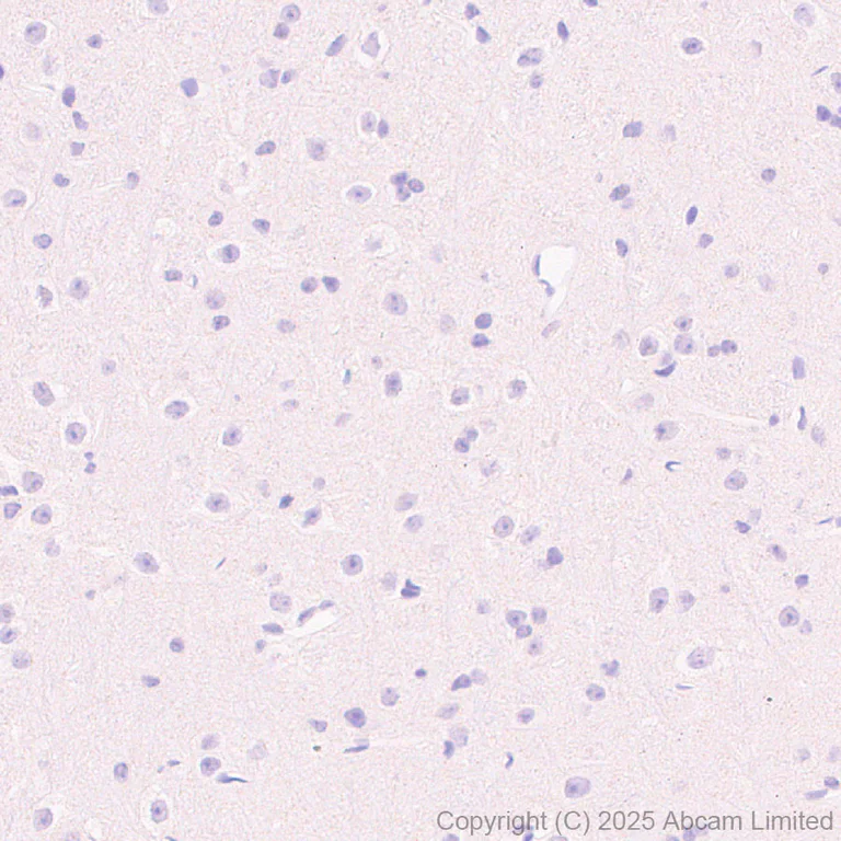 Immunohistochemistry (Formalin/PFA-fixed paraffin-embedded sections) - Anti-TDO2/TDO antibody [EPR29352-720] - BSA and Azide free (AB325328)