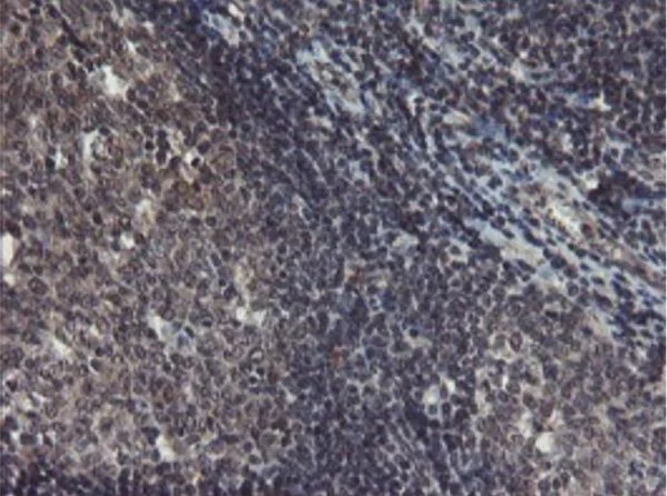 Immunohistochemistry (Formalin/PFA-fixed paraffin-embedded sections) - Anti-TDO2/TDO antibody [OTI2A4] - BSA and Azide free (AB273654)