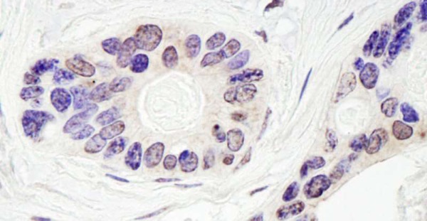 Immunohistochemistry (Formalin/PFA-fixed paraffin-embedded sections) - Anti-TDP1 antibody (AB224822)