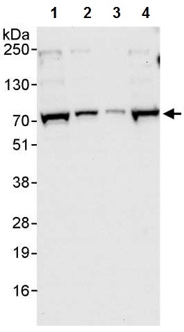 Western blot - Anti-TDP1 antibody (AB224822)