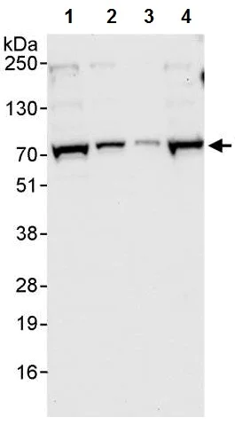 Western blot - Anti-TDP1 antibody (AB224822)