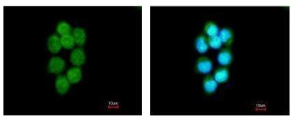 Immunocytochemistry/ Immunofluorescence - Anti-TDP1 antibody (AB227144)