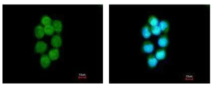 Immunocytochemistry/ Immunofluorescence - Anti-TDP1 antibody (AB227144)