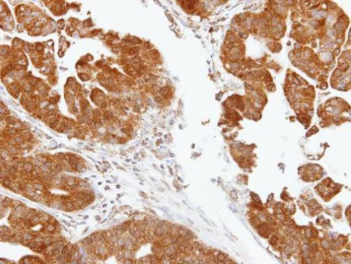 Immunohistochemistry (Formalin/PFA-fixed paraffin-embedded sections) - Anti-TDP1 antibody (AB227144)