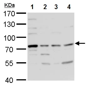 Western blot - Anti-TDP1 antibody (AB227144)