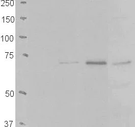 Western blot - Anti-TDP1 antibody (AB4166)