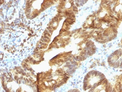 Immunohistochemistry (Formalin/PFA-fixed paraffin-embedded sections) - Anti-TDP2 antibody [TDP2/1258] (AB218476)