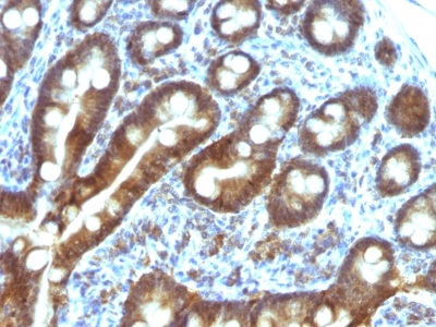 Immunohistochemistry (Formalin/PFA-fixed paraffin-embedded sections) - Anti-TDP2 antibody [TDP2/1258] (AB218476)