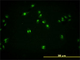Immunocytochemistry/ Immunofluorescence - Anti-TDP43 antibody [2E2-D3] (ab57105), expandable thumbnail