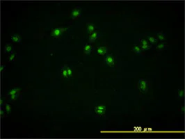 Immunocytochemistry/ Immunofluorescence - Anti-TDP43 antibody [2E2-D3] (AB57105)
