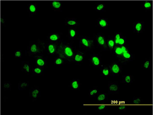 Immunocytochemistry/ Immunofluorescence - Anti-TDP43 antibody [2E2-D3] (AB57105), expandable thumbnail