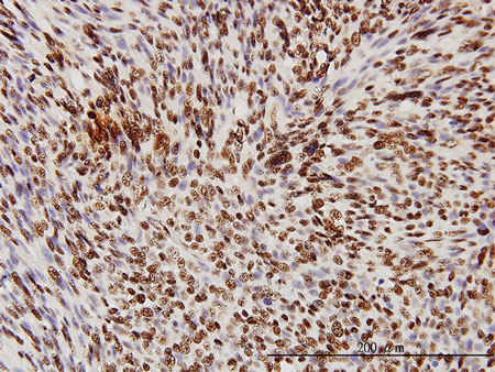 Immunohistochemistry (Formalin/PFA-fixed paraffin-embedded sections) - Anti-TDP43 antibody [2E2-D3] (AB57105), expandable thumbnail