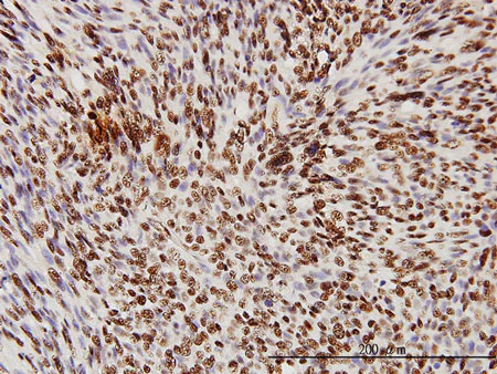 Immunohistochemistry (Formalin/PFA-fixed paraffin-embedded sections) - Anti-TDP43 antibody [2E2-D3] (AB57105)